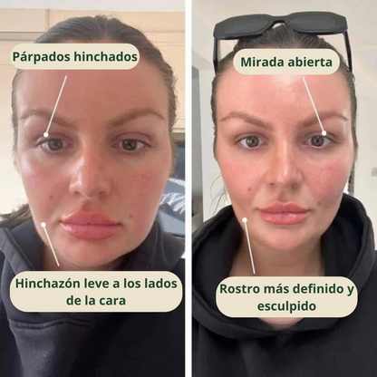 Nature™ | Drena Naturalmente la Hinchazón del Rostro, Abdomen y Piernas