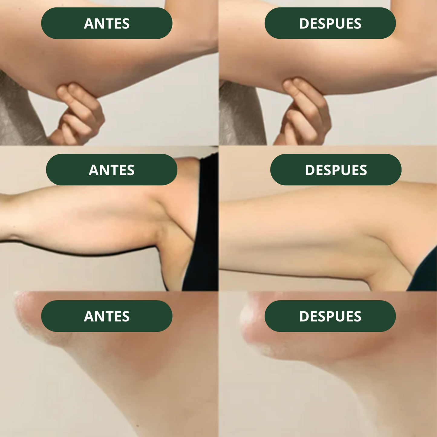 Nature™ | Drena Naturalmente la Hinchazón del Rostro, Abdomen y Piernas