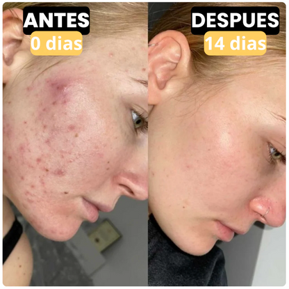 Nuvana®⎮Bálsamo de Sebo de Res